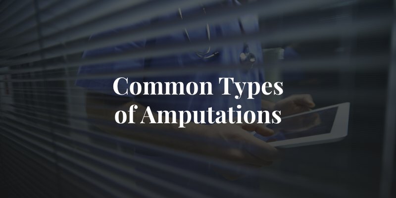 Common types of amputations